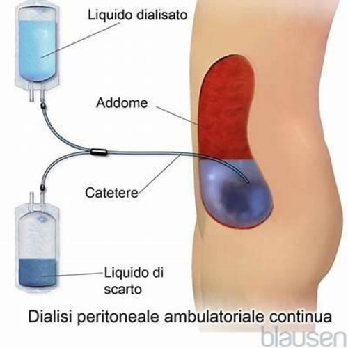 Libri Laura Giacomelli - CAPD Dialisi Peritoneale Ambulatoriale Continua NUOVO SIGILLATO SUBITO DISPONIBILE