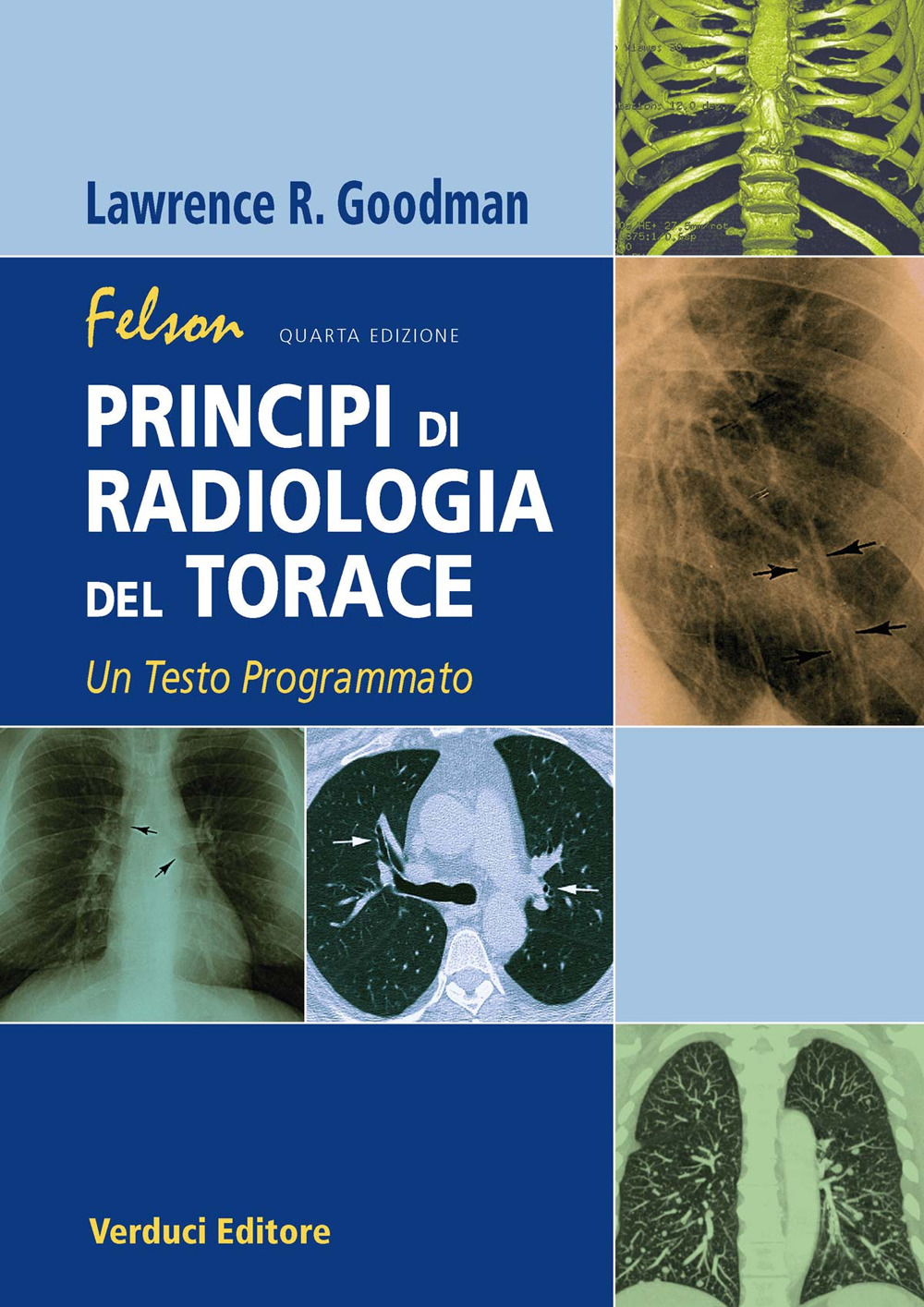 Libri Goodman Lawrence R. - Felson. Principi Di Radiologia Del Torace. Un Testo Programmato NUOVO SIGILLATO, EDIZIONE DEL 30/06/2018 SUBITO DISPONIBILE
