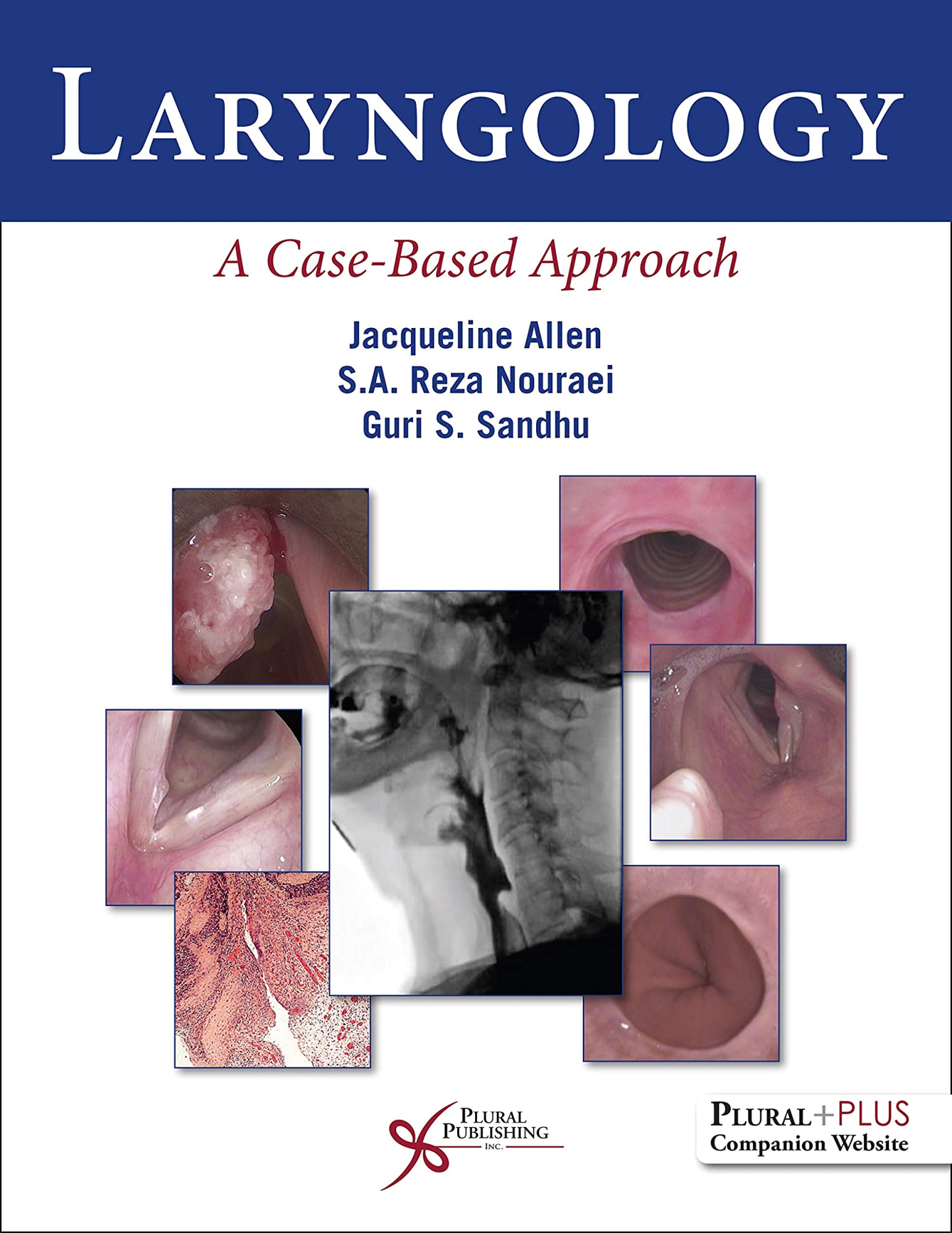 Libri Allen, Nouraei, Sandhu - Laryngology: A Case Based Approach NUOVO SIGILLATO, EDIZIONE DEL 01/03/2019 SUBITO DISPONIBILE