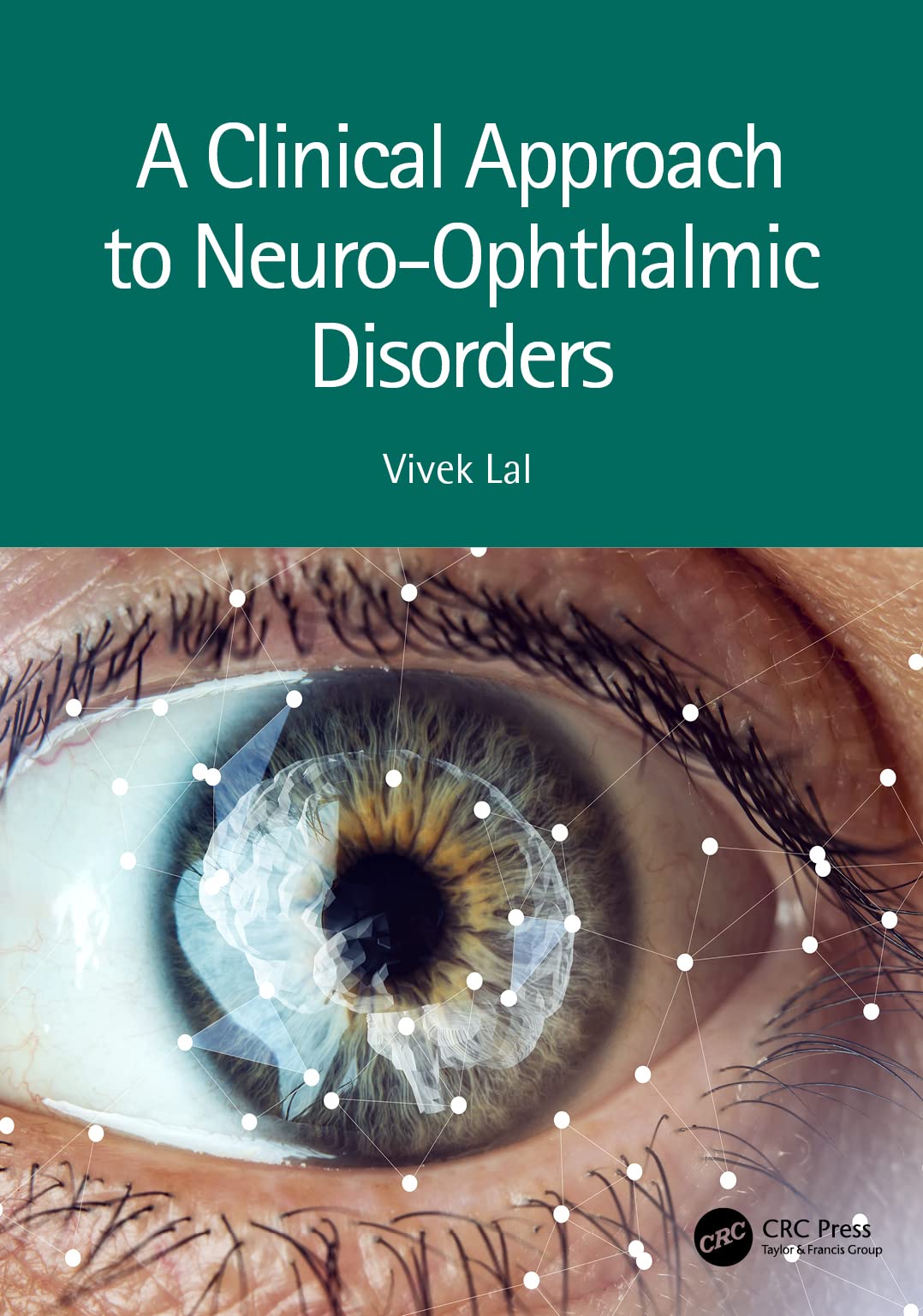 LIbri UK/US A Clinical Approach To Neuro-Ophthalmic Disorders NUOVO SIGILLATO, EDIZIONE DEL 14/07/2022 SUBITO DISPONIBILE